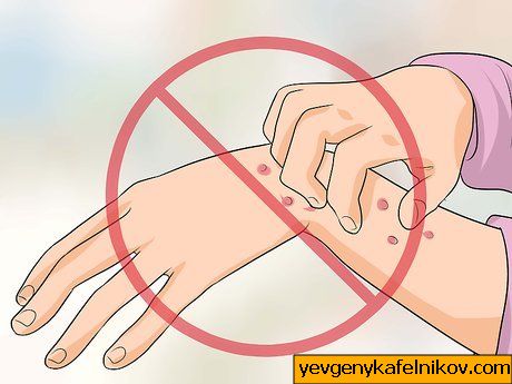Kako noću ublažiti svrbež ruku i nogu