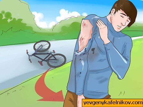 Kako liječiti osip na cesti